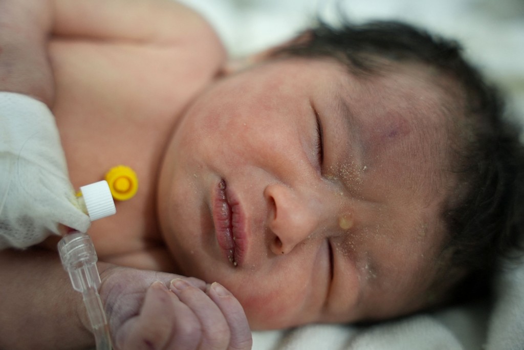 EDITORS NOTE: Graphic content / A newborn baby who was found still tied by her umbilical cord to her mother and pulled alive from the rubble of a home in northern Syria following a deadly earthquake, receives medical care, at a clinic in Afrin, on February 7, 2023. - The infant is the sole survivor of her immediate family, the rest of whom were all killed when a 7.8-magnitude quake that struck Syria and neighbouring Turkey flattened the family home in the rebel-held town of Jindayris, cousin Khalil al-Suwadi said. (Photo by Rami al SAYED / AFP) (Photo by RAMI AL SAYED/AFP via Getty Images)